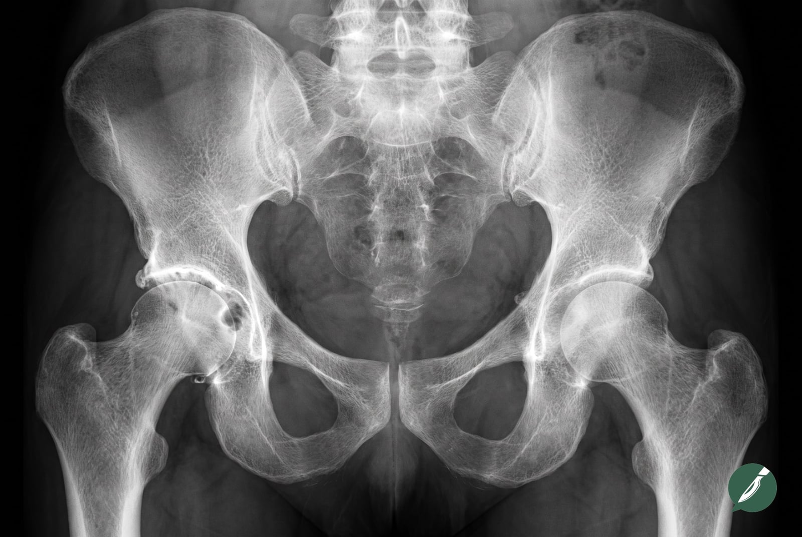 Radiograph for this scenario